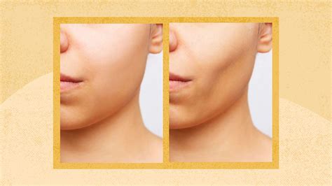 Buccal fat: Overview, removal process, cost, and more .